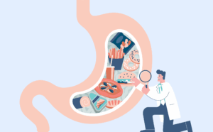 bland diet menu for gastritis