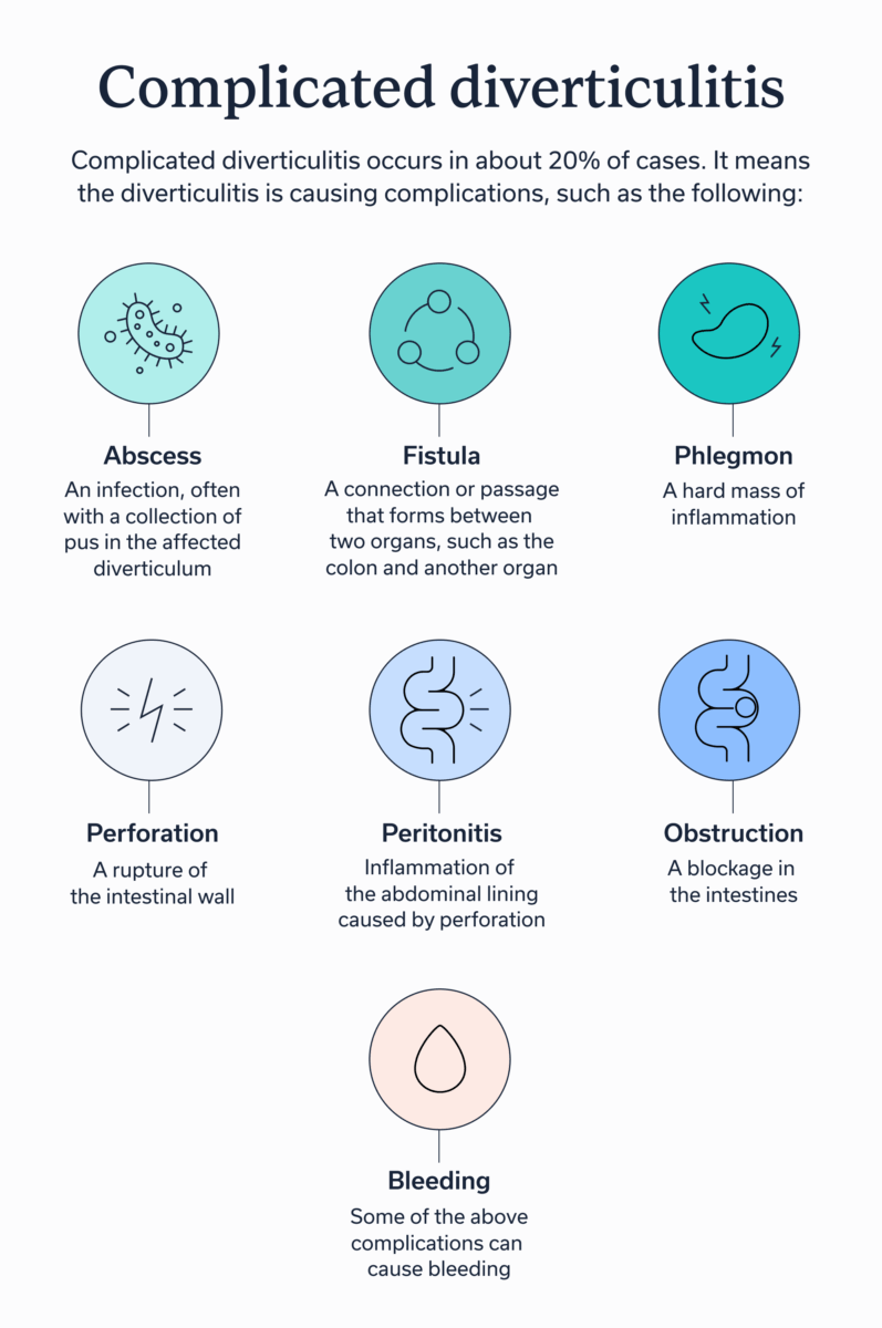 Symptoms of complicated diverticulitis