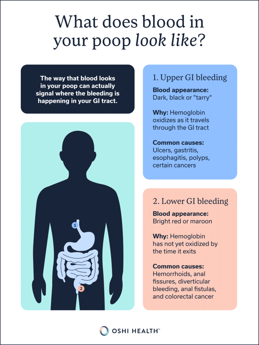 What does blood in your poop look like?