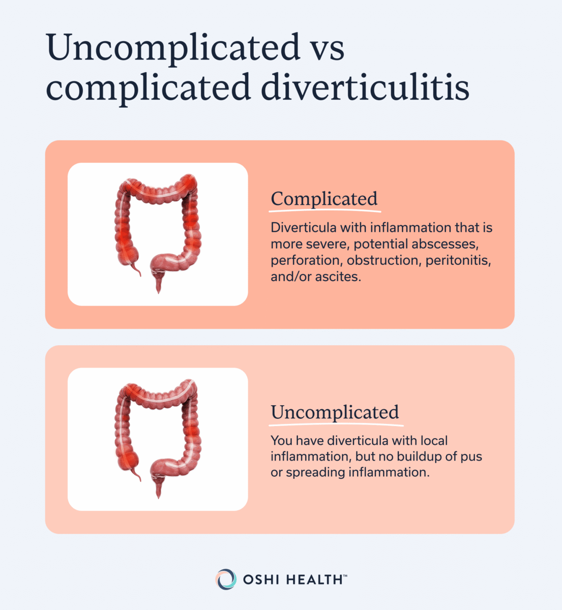 Uncomplicated vs complicated diverticulitis