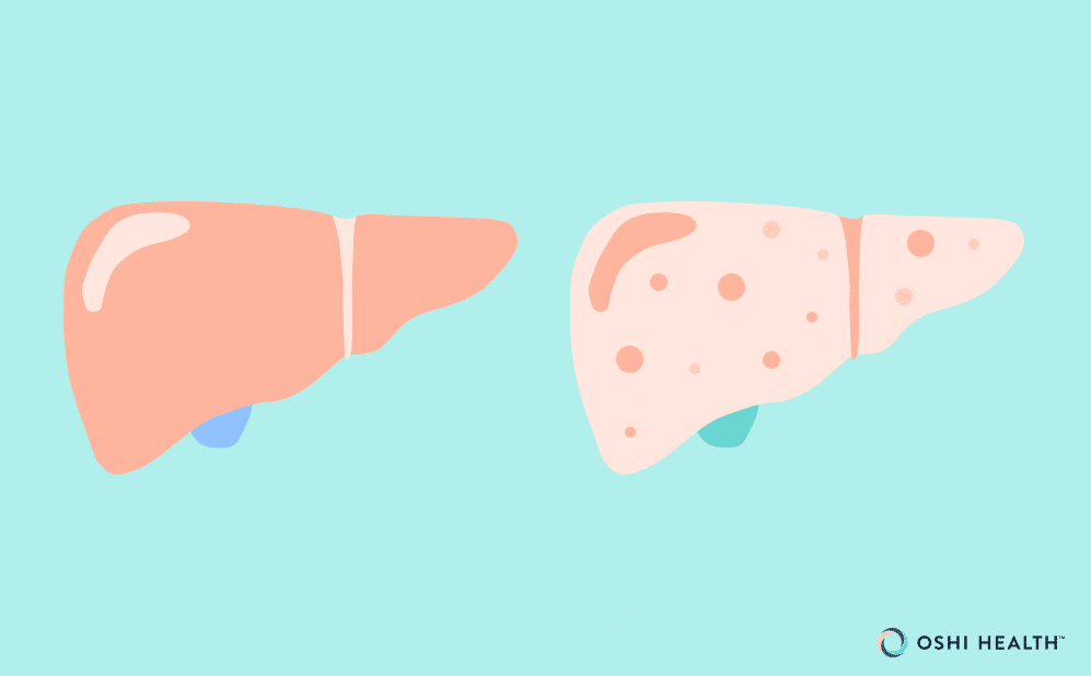 7 signs your liver is dying