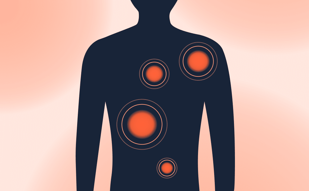 Illustration of a person's upper body with glowing red circles highlighting areas where gallbladder pain may be felt.
