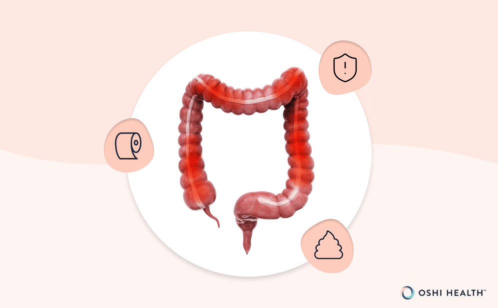 Illustration of the colon highlighting symptoms associated with fecal impaction.