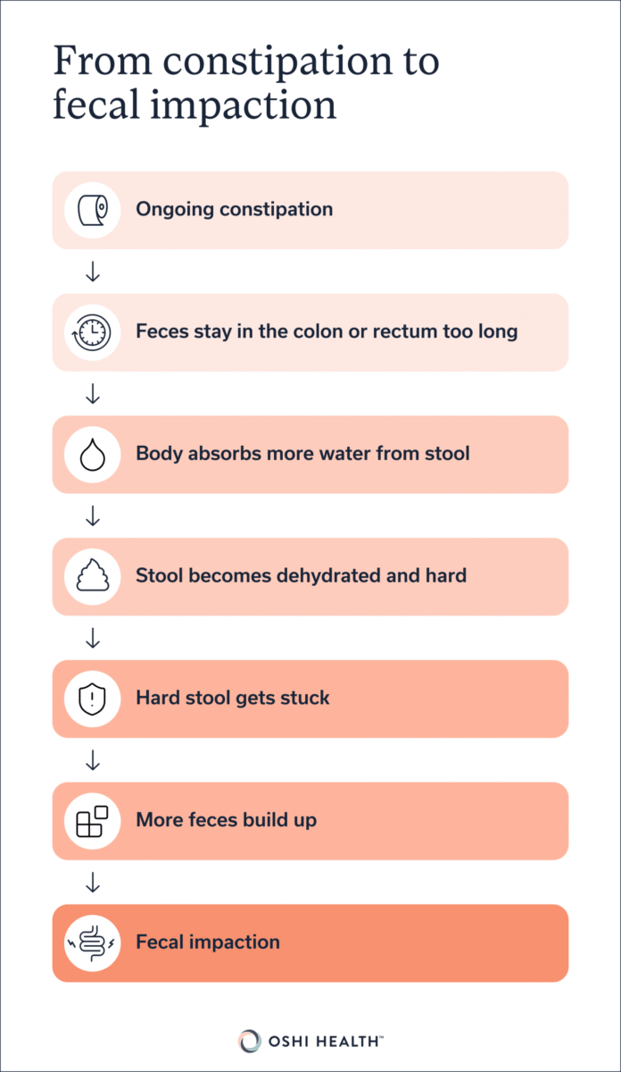 Infographic showing how ongoing constipation can progress to fecal impaction.